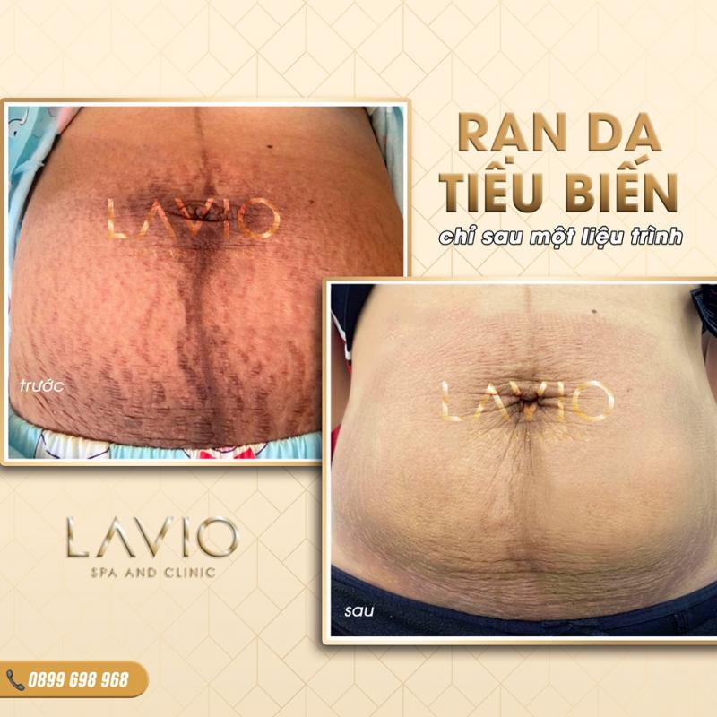 LAVIO Spa & Clinic Cần Thơ
