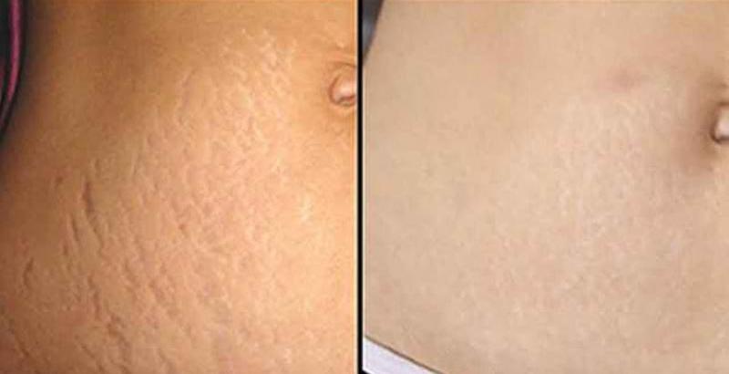 Loan Spa Cần Thơ