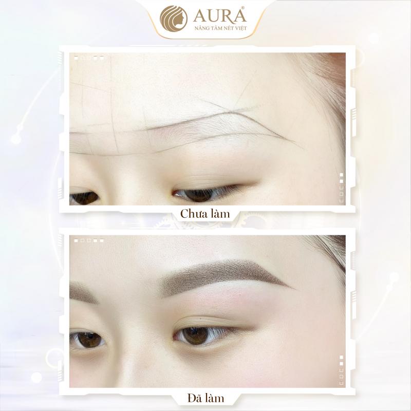 Thẩm Mỹ Quốc Tế Aura - Cần Thơ