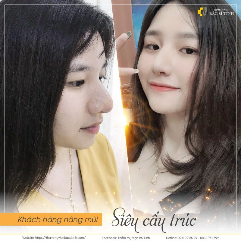 THẨM MỸ VIỆN BÁC SĨ TÍNH