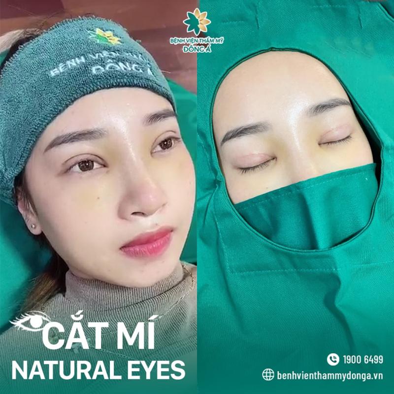 Thẩm mỹ viện Đông Á Cần Thơ