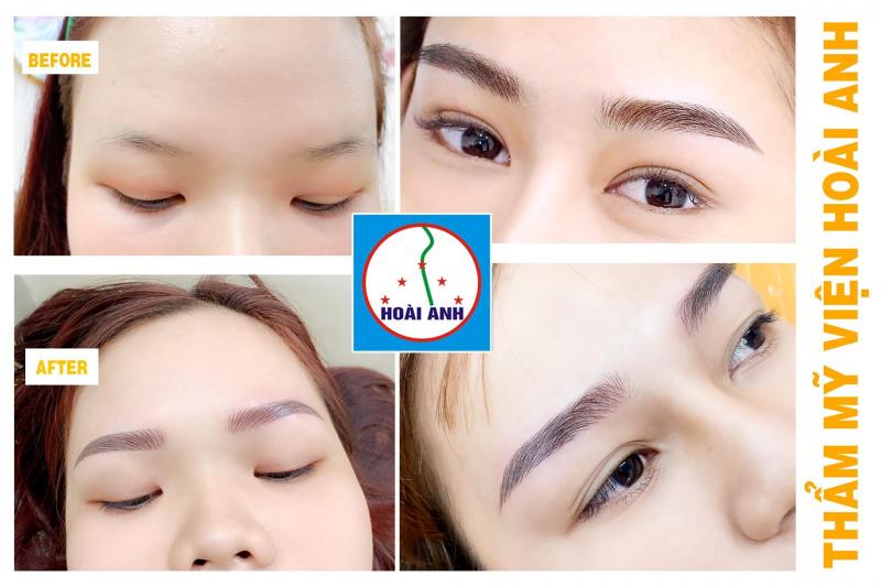 Thẩm mỹ viện Hoài Anh